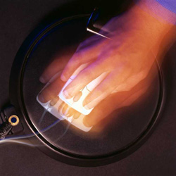 Symptoms of Carpal Tunnel Syndrome