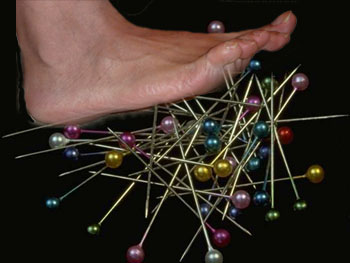 Neuropathy
