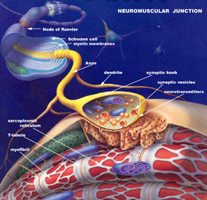 Cause of Myasthenia Gravis